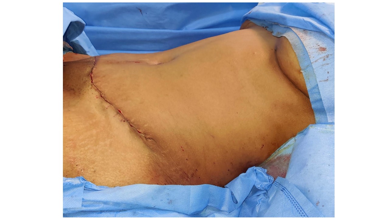 Suvarna Talk Photo 7